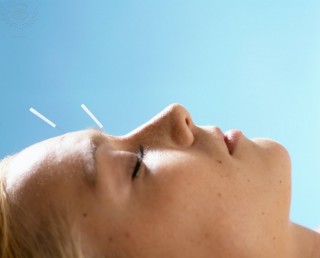 rostro de mujer en una sesión de acupuntura