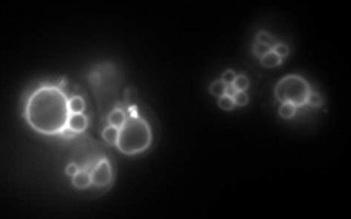 Células de levadura teñidas para analizar el transporte de coenzima Q (imagen B/N)