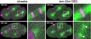 Detalle al microscopio de la envoltura nuclear LEMD2 