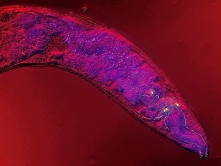 Caenorhabditis elegans al microscopio