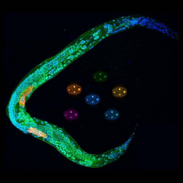 En la imagen, larva y embriones de ‘Caenorhabditis elegans’. En la larva se aprecia que MEL-28/ELYS (verde) se localiza en la envoltura nuclear que rodea la cromatina (azul) de todas las células. 