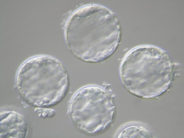 Embriones en estadio de blastocisto.