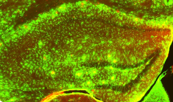 En verde se ve marcado el GFAP y, por tanto, los astrocitos reactivos en las zonas de patología, es decir, donde hay placas amiloides (en rojo).