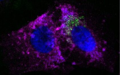 Acinetobacter baumannii (en verde), marcadas con anticuerpos dirigidos frente a su proteína de membrana externa (OmpA), se adhiere e invade una célula epitelial del utero human (en magenta) marcadas con anticuerpos dirigidos frente a una de sus proteínas superficiales (fibronectina). El núcleo celular (en azul) está marcado con DAPI.