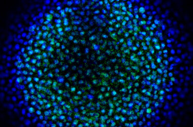 Inmunofluorescencia de un embrión de pez cebra. / CABD