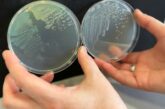 Placas con colonias de la bacteria Sphingopyxis granuli TFA utilizada en el estudio liderado por Francisca Reyes.