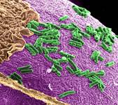 Microbiota instentinal